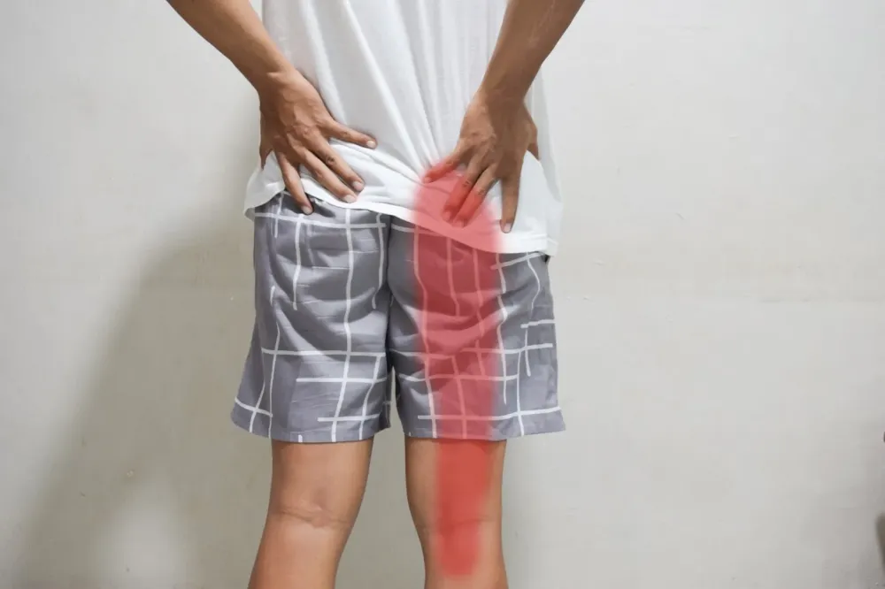 sciatiques